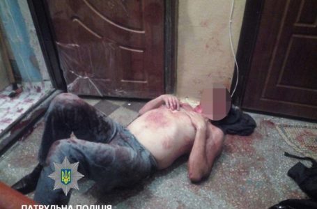 У Тернополі мешканця багатоповерхівки госпіталізували через бійку з хуліганом