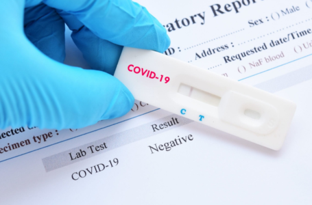 На COVID-19 обов’язково тестуватимуть медиків і всіх з ознаками хвороби