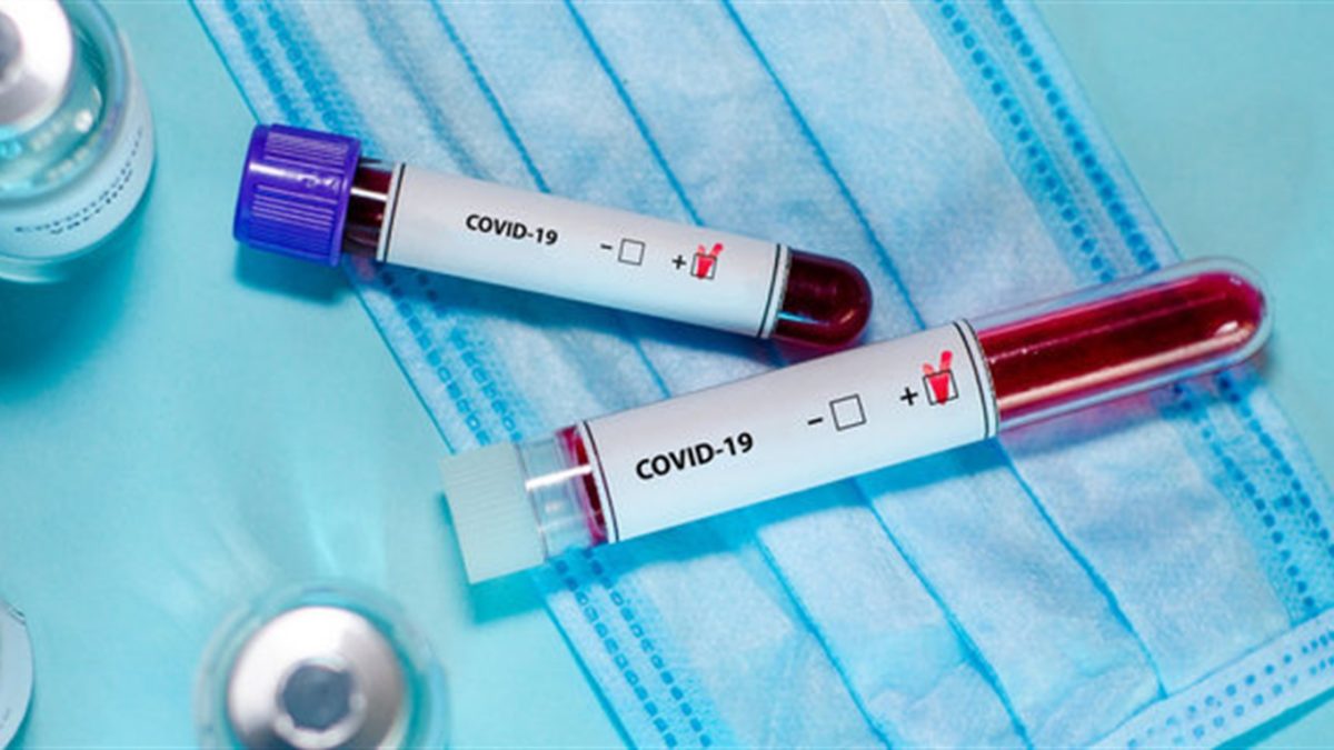 У Тернопільській області – 32 нових випадки коронавірусу